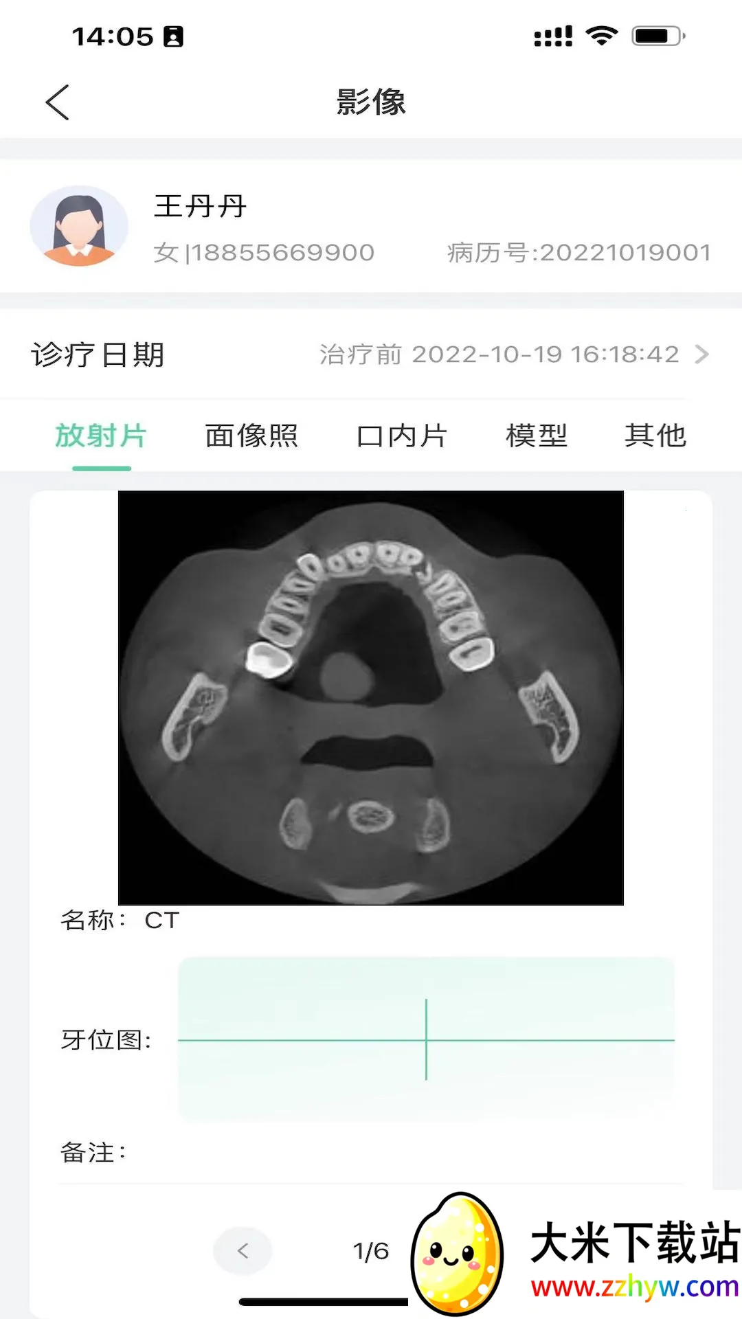 ��������v0.1.0 �ֻ����ͼ