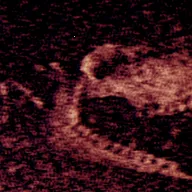 ����Steam��ֲ2026�ٷ����°汾