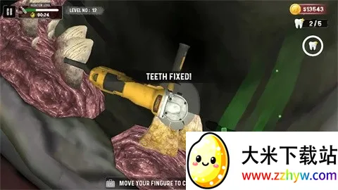 鲨鱼牙医模拟器(鲨鱼看牙游戏) 鲨鱼牙医模拟器(鲨鱼看牙游戏)