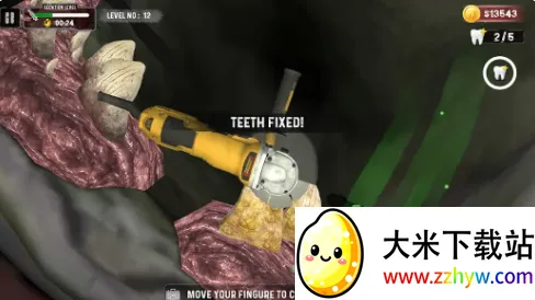 鲨鱼牙医模拟器(鲨鱼看牙游戏) 鲨鱼牙医模拟器(鲨鱼看牙游戏)